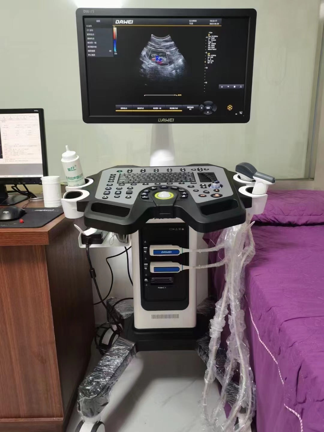 Appareil d'échographie cardiaque DAWEI F3